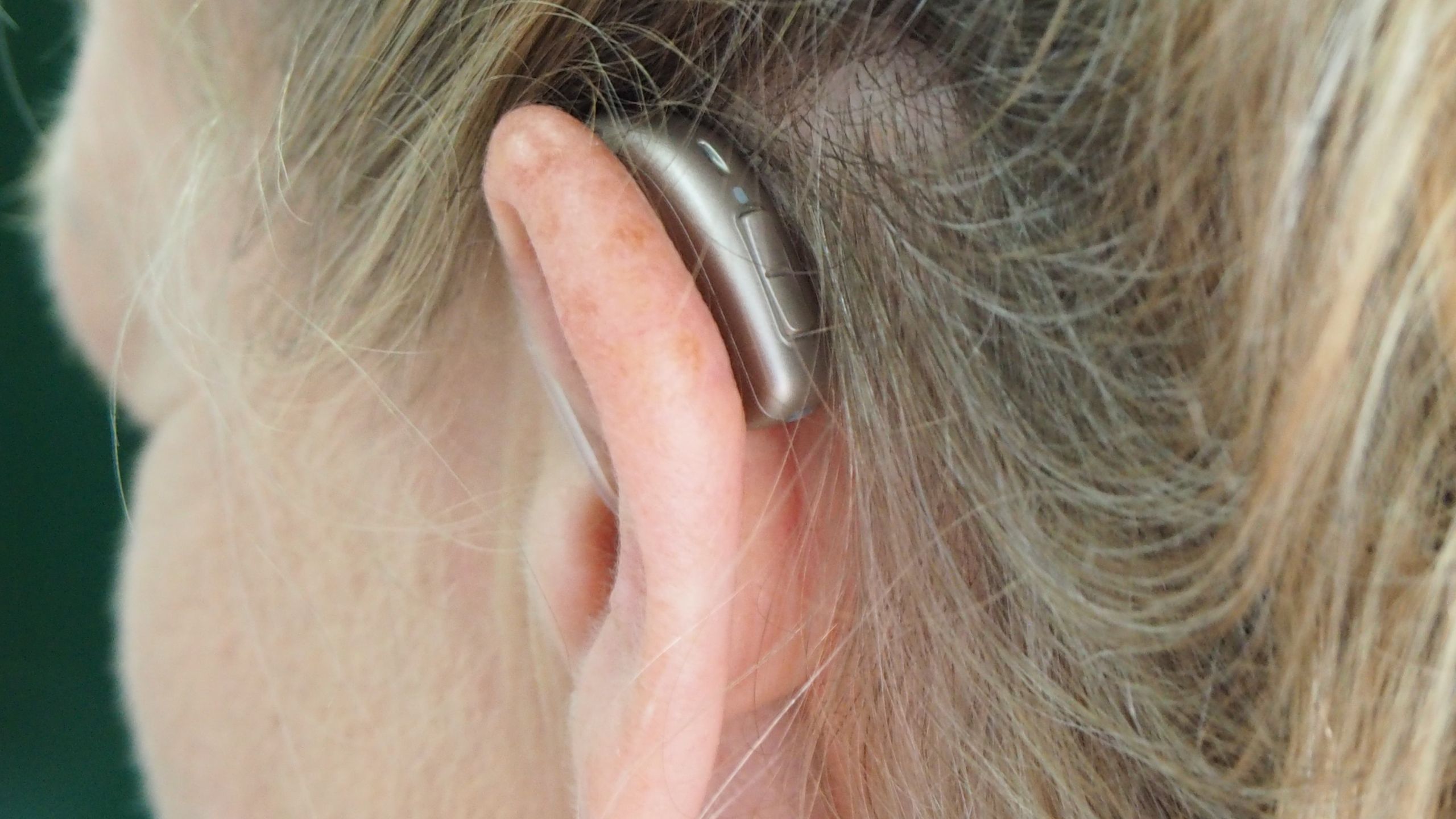 A behind-the-ear hearing aid on a person's left ear.
