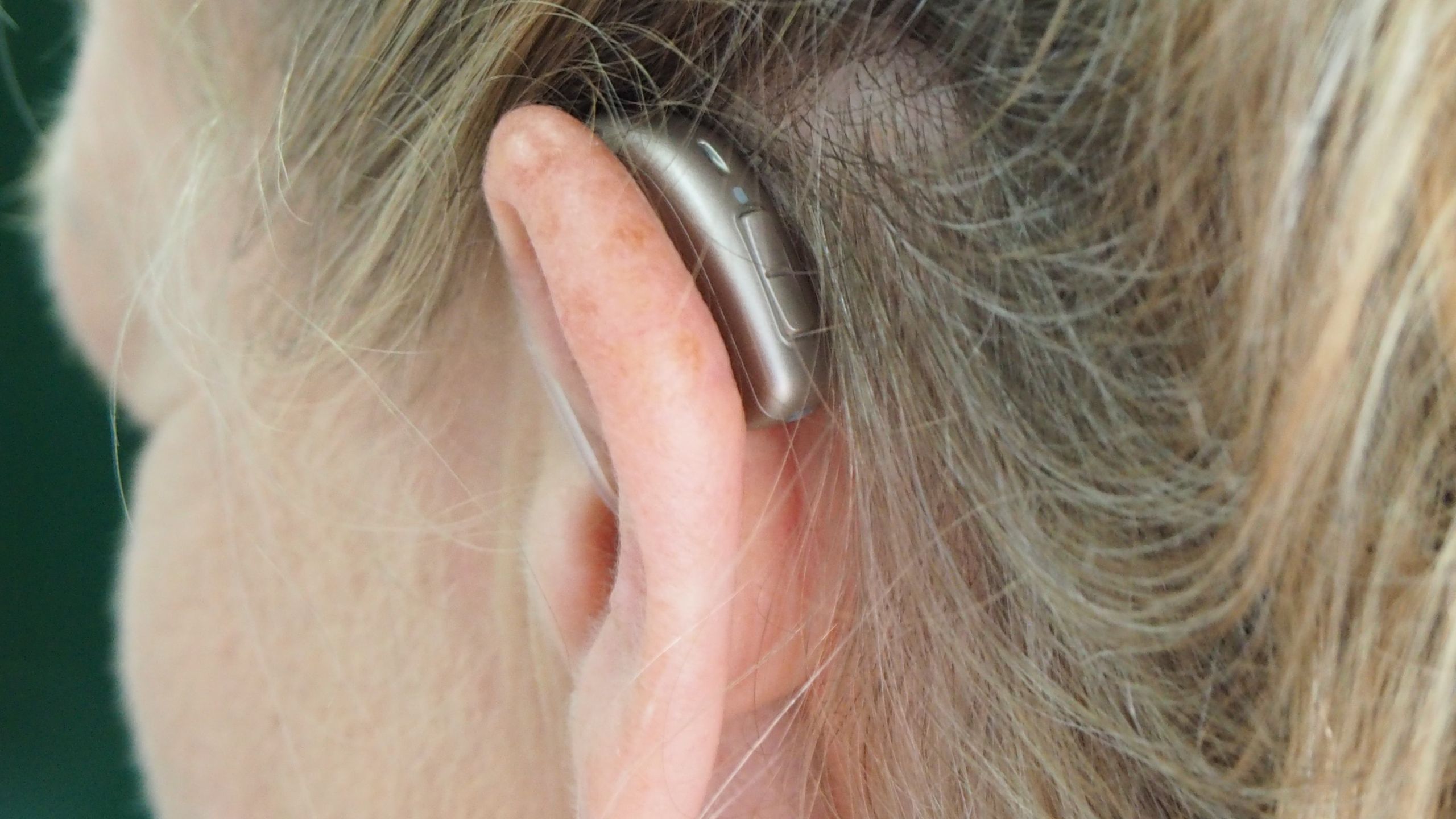 Middle-Aged Woman Wearing BTE Hearing Aid A behind-the-ear hearing aid on a person's left ear.