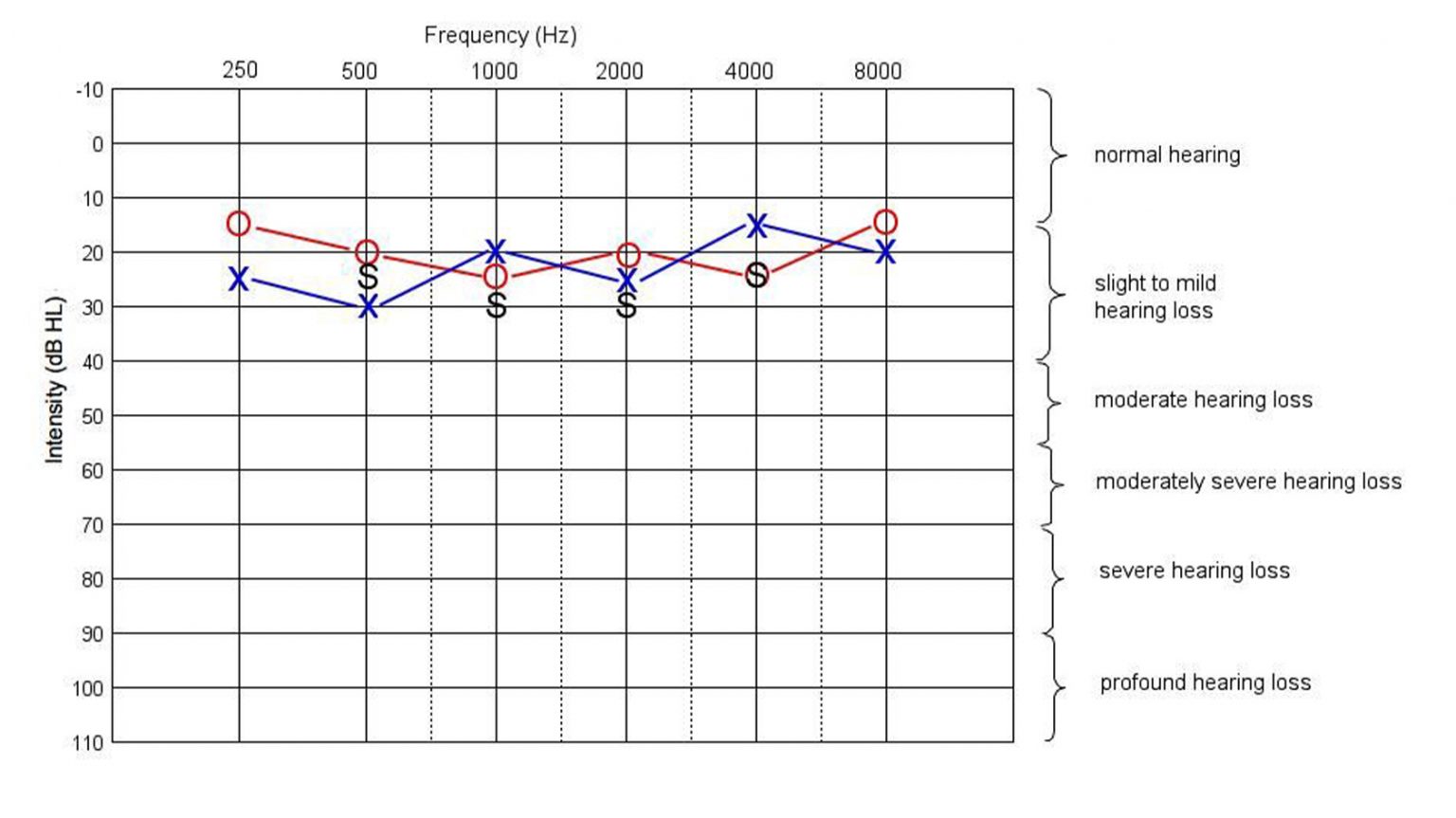 How do you get a good fit with hearing aids? - SoundGuys