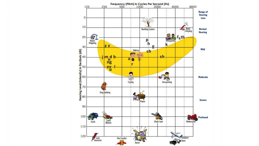 An audiogram showing the frequency and volume of familiar sounds like birds chirping or dog barking.