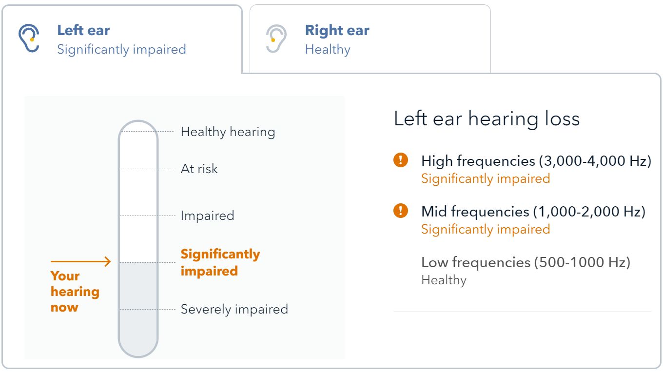 Hearing test result showing left and right ear separately.