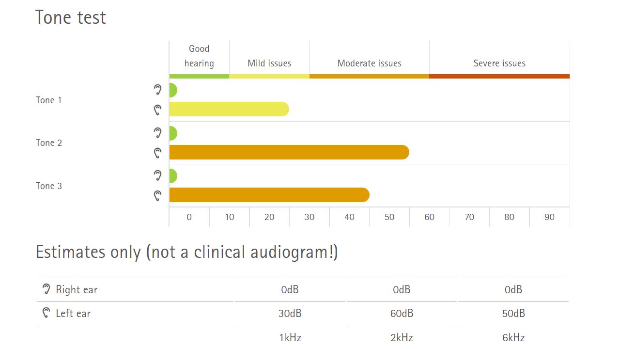 Hearing test result with amount of hearing loss for three different tones.