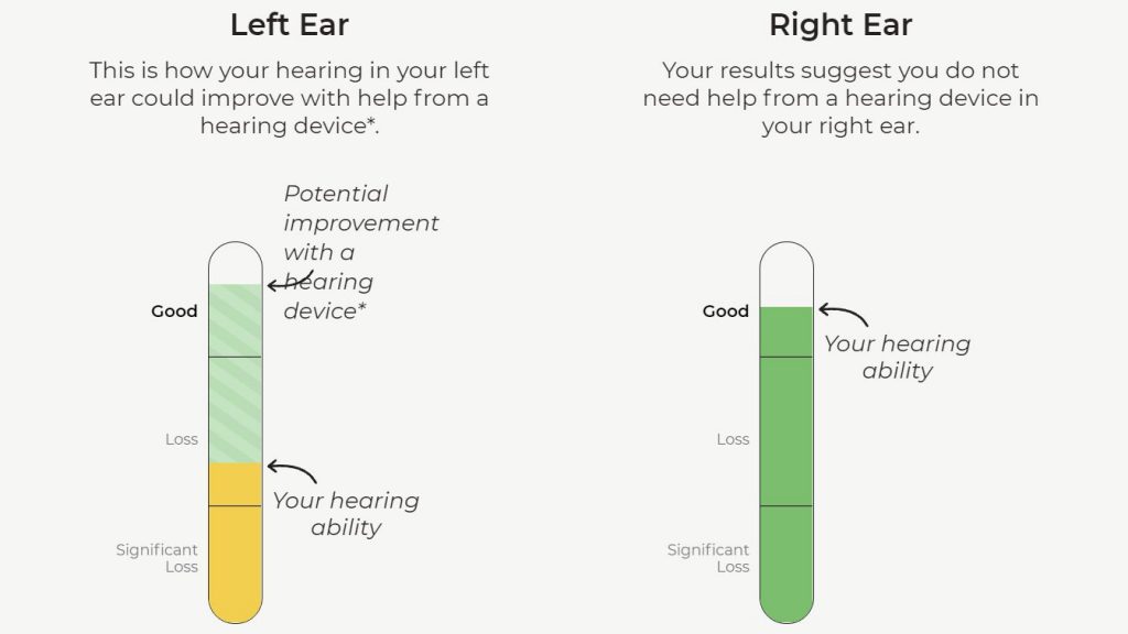 Hearing test showing hearing loss in the left ear and normal hearing in the right ear.